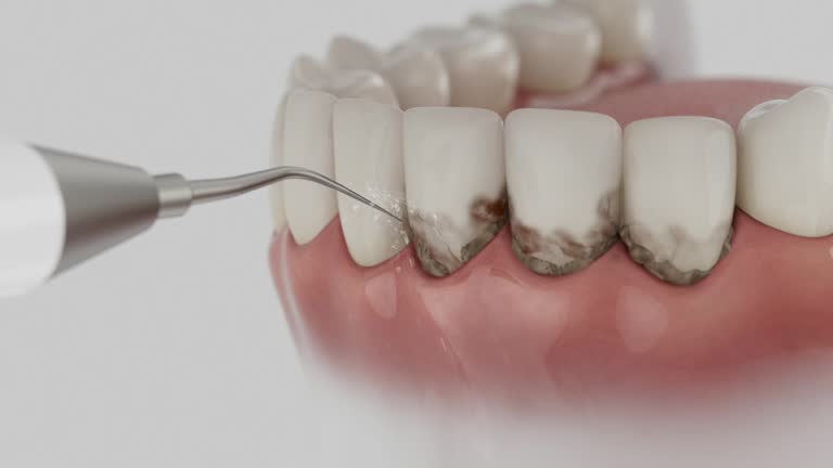 Reliable Dental contractor in Wilkesboro, NC by Dentist Open Now